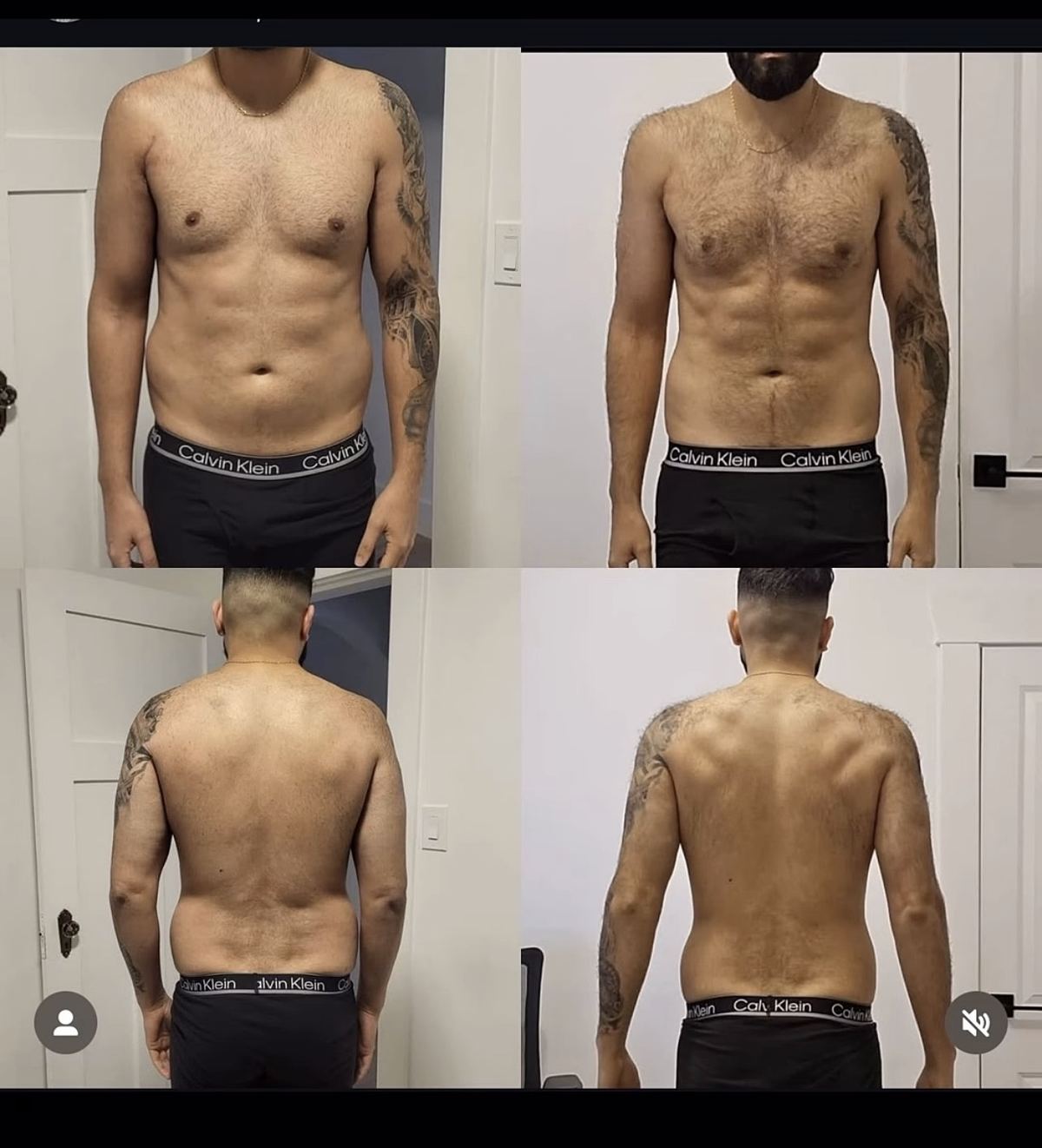 Anonymous: Pec rehab + 10 lbs down